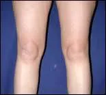 Le Cheval a 2 genoux ?