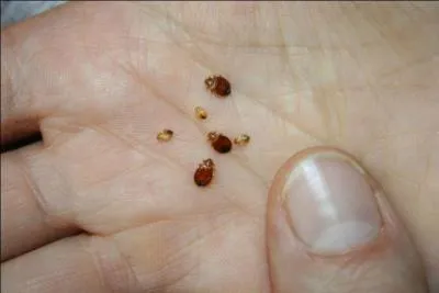 De quoi peut tre suivie une piqre de punaise de lit ?