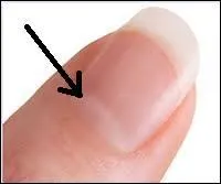 Comment appelle-t-on la zone plus claire situe  la base de l'ongle ?