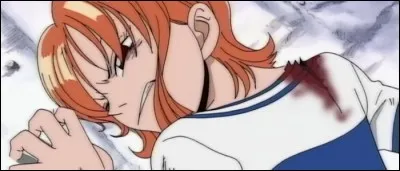 Épisode 14 - Nos héros se récoltent diverses blessures durant le combat... Où et comment ?
(3 réponses)