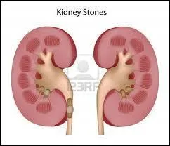 Combien devons-nous tre pour devenir un grand peintre du mouvement fauvisme ?