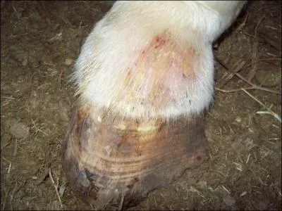 Qu'est-ce que les lymphangites ?