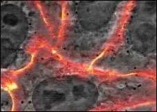 Une nouvelle molcule appele HB 19 permettrait de stopper la progression du cancer. Qui a servi de cobaye lors des essais ?