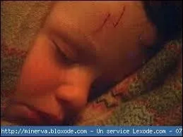 Pourquoi Harry Potter a-t-il une cicatrice en forme d'clair sur le front ?