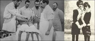 Le 9 fvrier, le docteur Eugne Louis Doyen russit une opration incroyable : il spare les clbres soeurs siamoises du cirque Barnum. De quelle nationalit est ce grand chirurgien ?