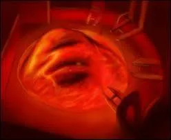 Cette crature s'appelle-t-elle  Nestene  ?