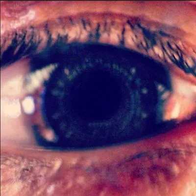 A qui appartient cet oeil ?