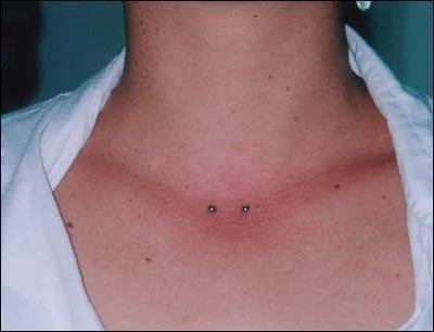 Quel est le nom de ce piercing ?