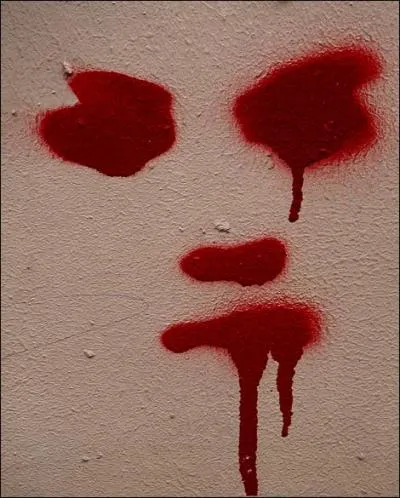 tat du sang qui prsente une acidit excessive :