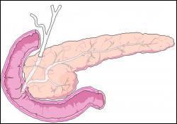 Le pancras est une glande ancre sur la partie proximale de duodnum. Son rle est la rgulation de la glycmie (taux de sucre dans le sang) par la scrtion de deux hormones. 
Laquelle a un rle hyperglycmiant ?