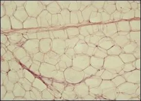 Eh oui, mme notre graisse assure un rle hormonal ! L'une des hormones que scrte le tissu adipeux joue mme un rle dans le cycle menstruel : elle indique au cerveau que les quantits nergtiques sont suffisantes pour assurer une gestation et permet d'enclencher alors la croissance de l'ovule. 
Comment se nomme cette hormone ?