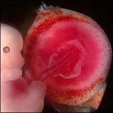 Outre son rle d'change avec le foetus, le placenta a un rle hormonal permettant de maintenir l'utrus en condition d'accueillir le foetus. 
Quelle est cette hormone ?