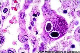''Cytomégalovirus'' est un mot qui a la particularité d'être le nom le plus long (15 lettres) à alterner régulièrement consonnes et voyelles. ''Virus'' , ça veut dire virus (facile), mais que veulent dire ''cyto'' et ''mégalo'' ?