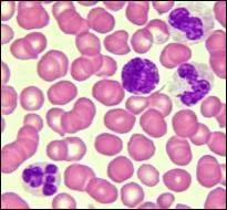 La premire des dix catastrophes ( les dix plaies d'Egypte) frappa le Nil, le fleuve nourricier de l'Egypte. De quelle manire ?