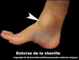 Quelle est cette partie du corps humain ?