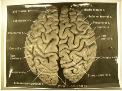 Voici le cerveau d'Einstein tel que conserv. Les chercheurs amricains et leurs collgues chinois ont analys... photographies du cerveau du gnie. De combien de photos ont-ils eu besoin pour mener leur exprience ?