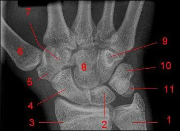 Les os du poignet forment ...