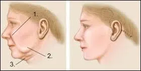 Le baiser est bon pour la peau, vrai ou faux ?