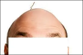 Dans la chanson de Michel Polnareff, o n'y a-t-il qu'un cheveu ?