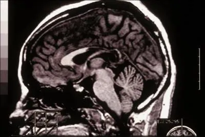 Retrouvez, dans ces réponses, une séquelle "prouvée" par les victimes et, bien sûr, les psychiatres :