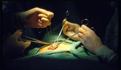 Lors d'une longue opration, il y a au moins 17 intervenants. Lequel ne doit pas s'absenter, mme une seconde.