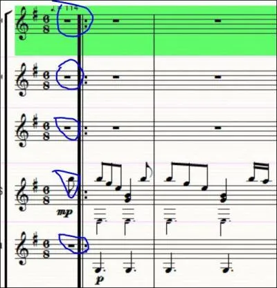 Qu'est-ce qu'une anacrouse ?