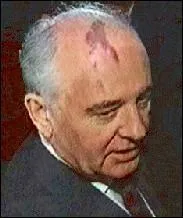 Comment s'appelle cette pathologie dermatologique, tache sur la peau de couleur rougetre  violac, aux contours variables ?