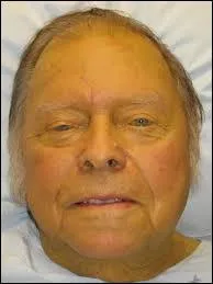 Quel mot est synonyme de jaunisse ?