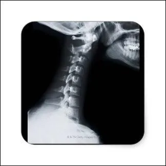 De ces trois animaux, cochez celui qui a le plus de vertbres dans le cou.