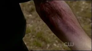 Vers la fin de la saison, il est mordu par un loup-garou. Qui ?