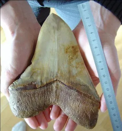  qui appartient cette dent ?