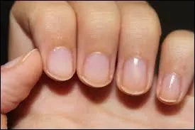 Quel nom porte ce produit que l'on s'applique sur les ongles ?