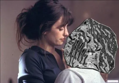 Dfigur  la suite d'un accident dans  Vanilla Sky , c'est :