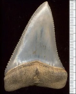  qui appartient cette dent ?