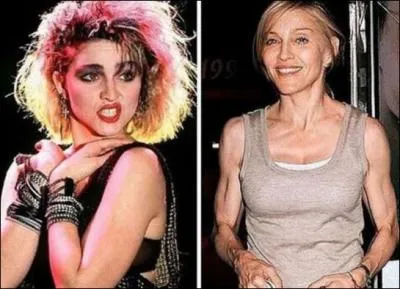 On a beau faire du sport et tout ce que l'on veut, rien  faire, il faut y passer, on ne fait pas disparaitre des rides avec des pompes !