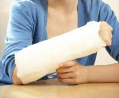 A vous de trouver o vous pourriez trouver un  Ulna , mais ne cherchez pas  le donner  un canid familier !