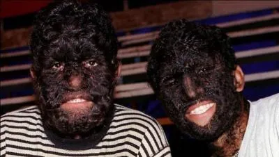 En 1574, on jugea un dnomm Gilles Garnier, il fut condamn  tre brl vif. Mais qu'est-ce que l'on reprochait  cet  homme  ?