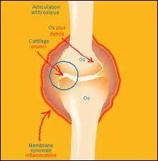 Qu'est-ce que le cartilage ?