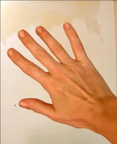 Comment appelle-t-on l'ensemble osseux constituant le poignet ?