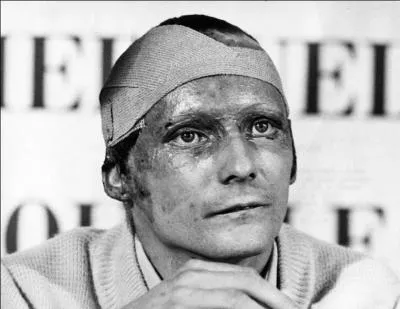En 1976, quel grand prix valut au pilote de Formule 1 Niki Lauda de graves brulures au visage et aux poumons ?
