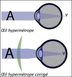 Un hypermtrope voit mal les objets proches. Pour corriger ce problme on utilise des verres ... .