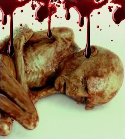  Elle avait la forme d'un petit enfant nu, recroquevill par terre, la peau  vif, rche, comme corche, et reposait, frissonnante, sous le sige o on l'avait laisse, rejete, cache  la vue, luttant pour respirer.  Qu'est-ce que c'est, selon Dumbledore ?