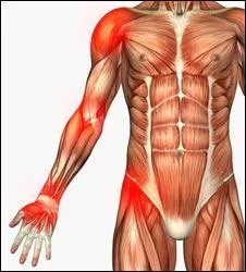 Quelle partie du corps est touche par la tendinite nomme communment  tennis-elbow  ?