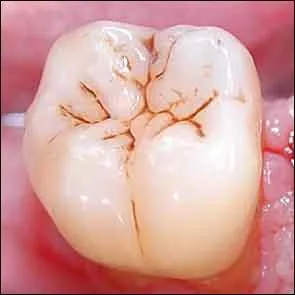 Quelle cuspide ne constitue aucune des molaires suprieures de l'ensemble des Vertbrs ?