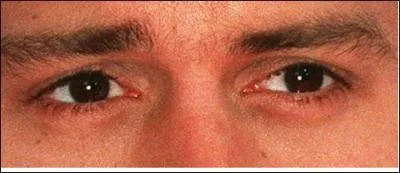 A qui appartiennent ces yeux ?