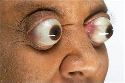 Sur combien de millim�tres cette femme peut-elle sortir ses yeux de leurs orbites ?