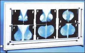 Quel est cet appareil mdical ?