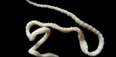 Parmi ces 3 sortes de vers intestinaux, lequel appelle-t-on "ver solitaire" ?