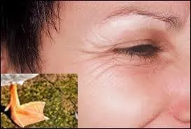 Quel animal correspond à ces deux images ?