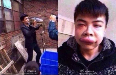 Qu'est-il arrivé à ce jeune homme !